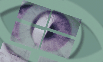 eye